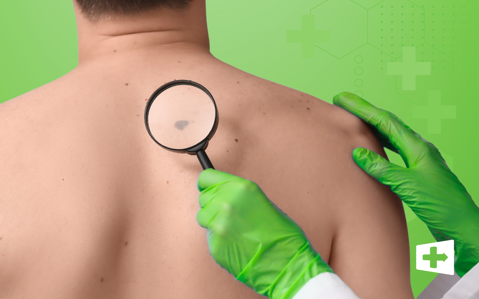 May is Melanoma Awareness Month: A Message from PA Danielle Costabile