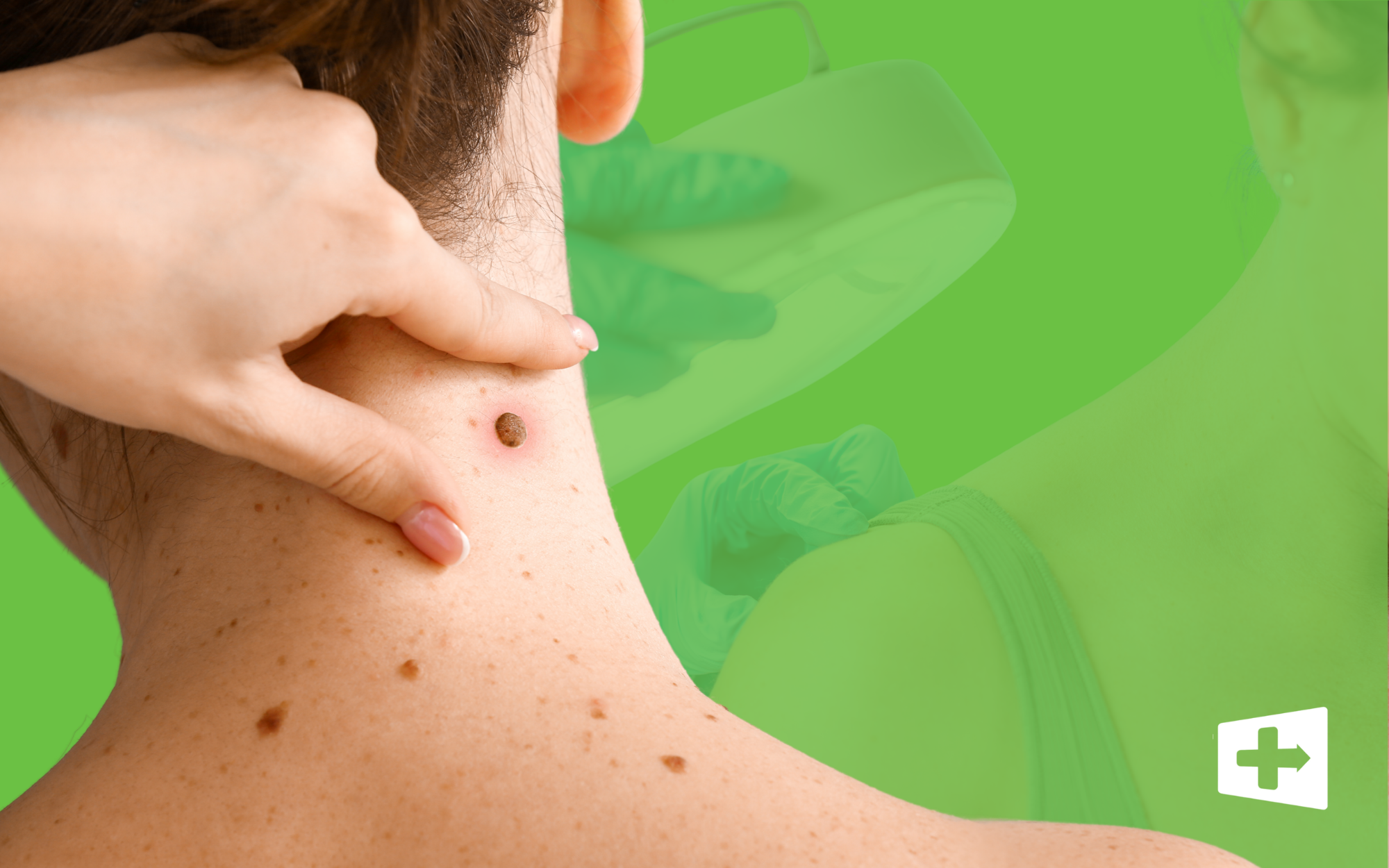 5 Skin Changes You Should Never Ignore