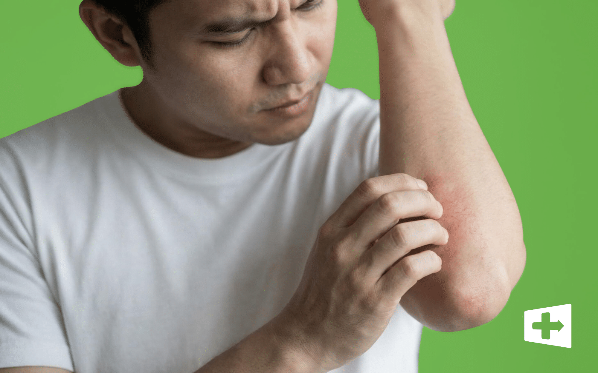 Eczema: It’s More Than Just Dry Skin. 7 Things You May Not Know